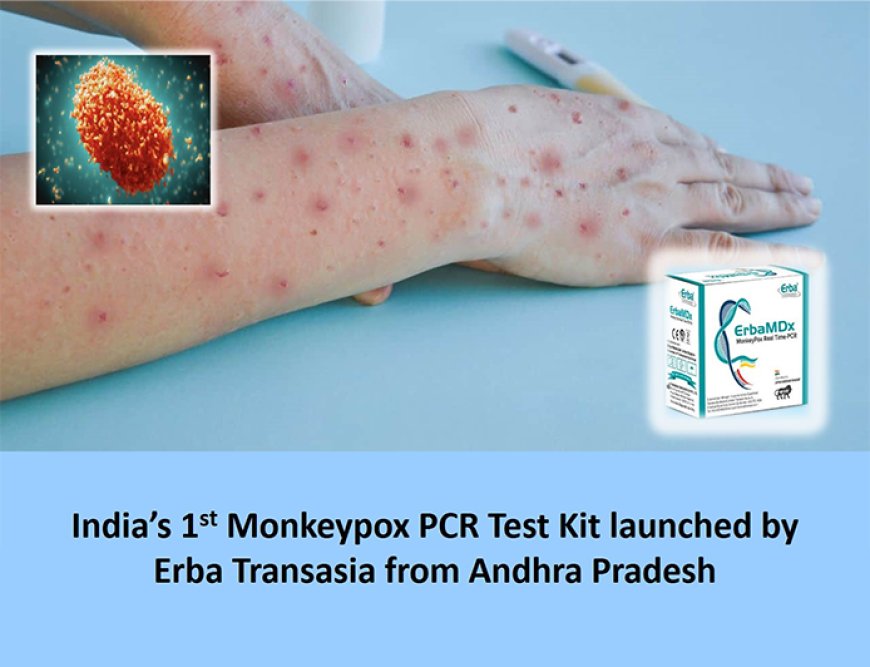 India’s 1st MonkeyPox PCR Test Kit launched by Erba Transasia from Andhra Pradesh